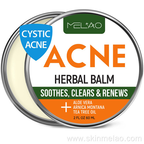 Pimple Repair Scar Acne Treatment Cream